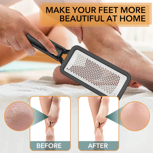 Stainless Steel Callus Remover