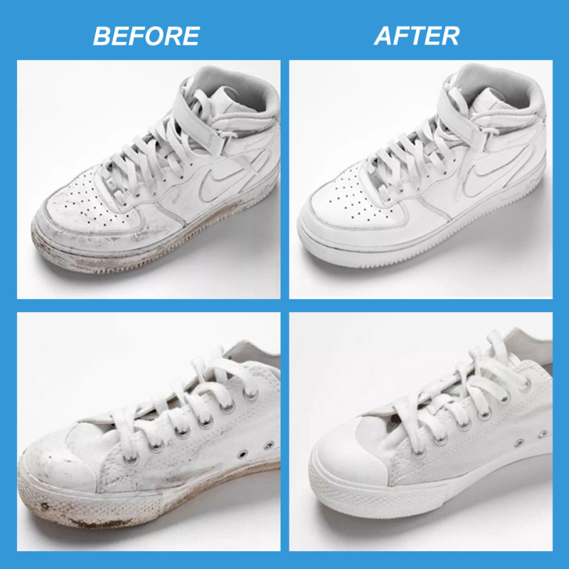 Fsyser™ Shoes Cleansing Gel Kit