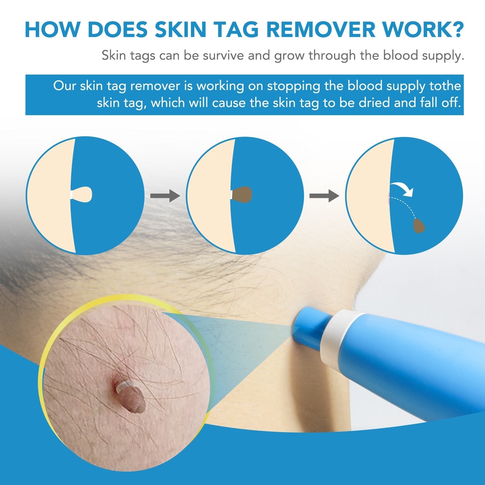 Auto Tag Removal Kit